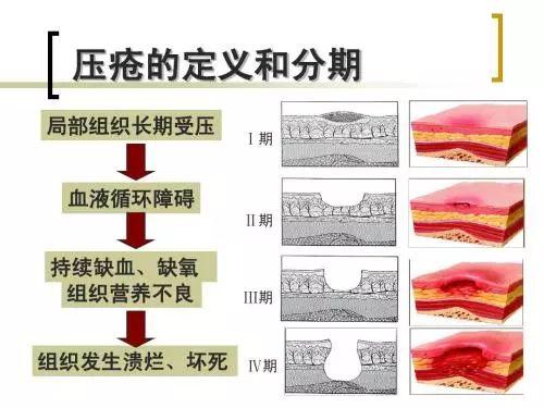 分期商品床上用品,分期购买床上用品，舒适家居生活的理想选择